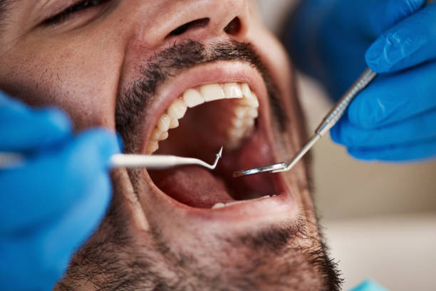 Best Tooth Pain Emergency Relief  in Smethport, PA